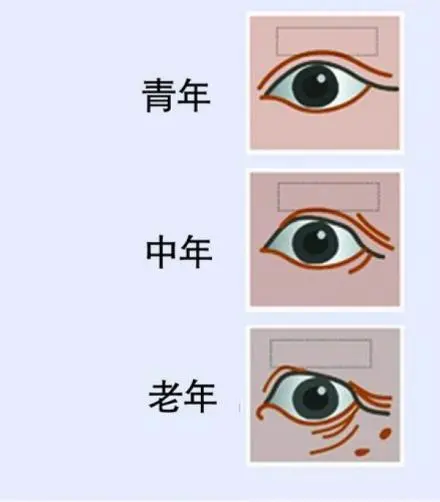 衰老到底是怎么回事呢,人老珠黄,人老珠黄是哪里黄